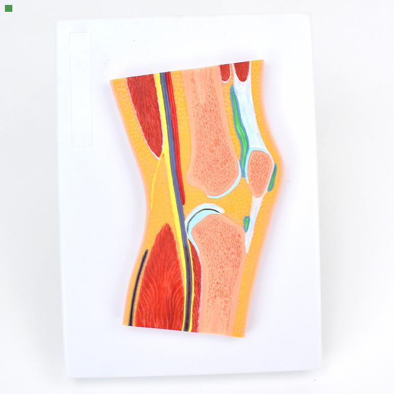 ENOVO颐诺医学 膝关节骨骼肌肉模型滑车关节构造MRI骨科教学模型