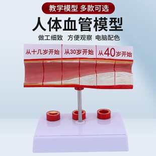 人体梗化支脉粥样心血管动脉解剖梗化模L型 血管血全形成模型