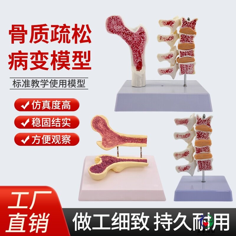 人体股骨骨质疏松解剖模型腿骨解剖面 H脊柱切面标本病变腰椎模型