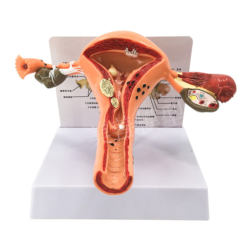 女性生殖模器模型女性生殖模器z模型私密子宫模型教具妇科卵巢解