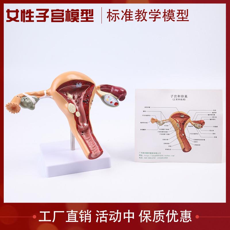 厂价直销女性内外生殖器解剖模型卵巢J子宫避孕指导模型计生模