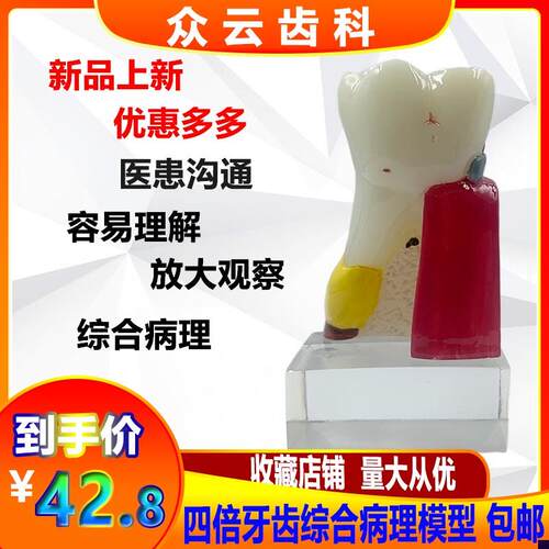 牙科口腔四倍综合病理模型 口z腔学生教学 医患沟通讲解模型包邮