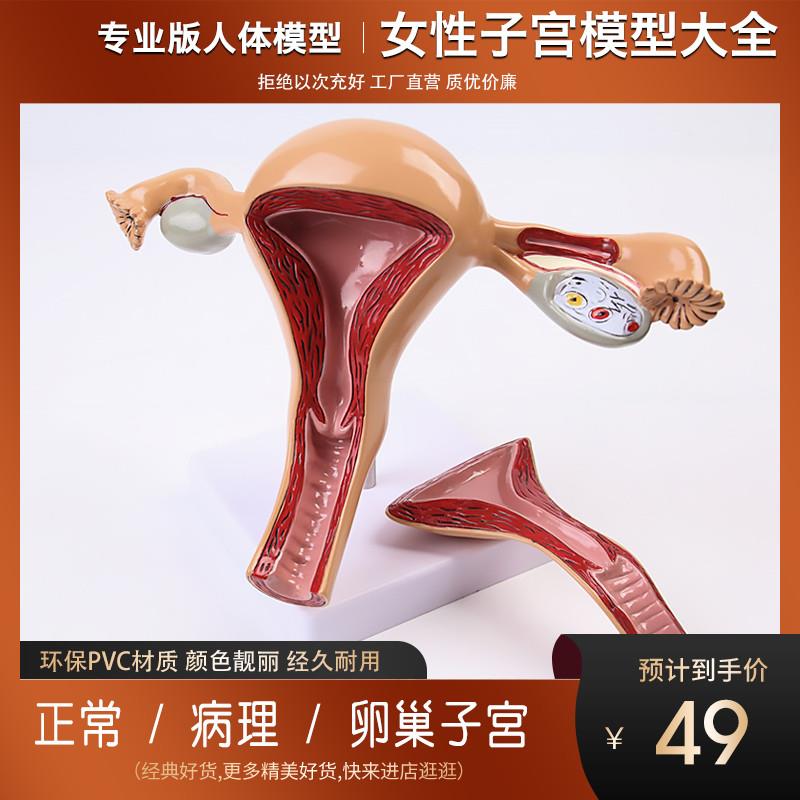 人体模型女性生殖子宫模型阴道卵巢模型教学模具U病理变化科学教