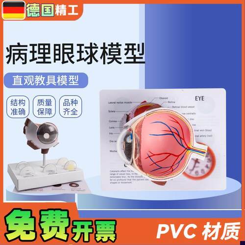 德国】病c理眼球模型 眼球模型 角膜病变眼球模型 医学教学教材模