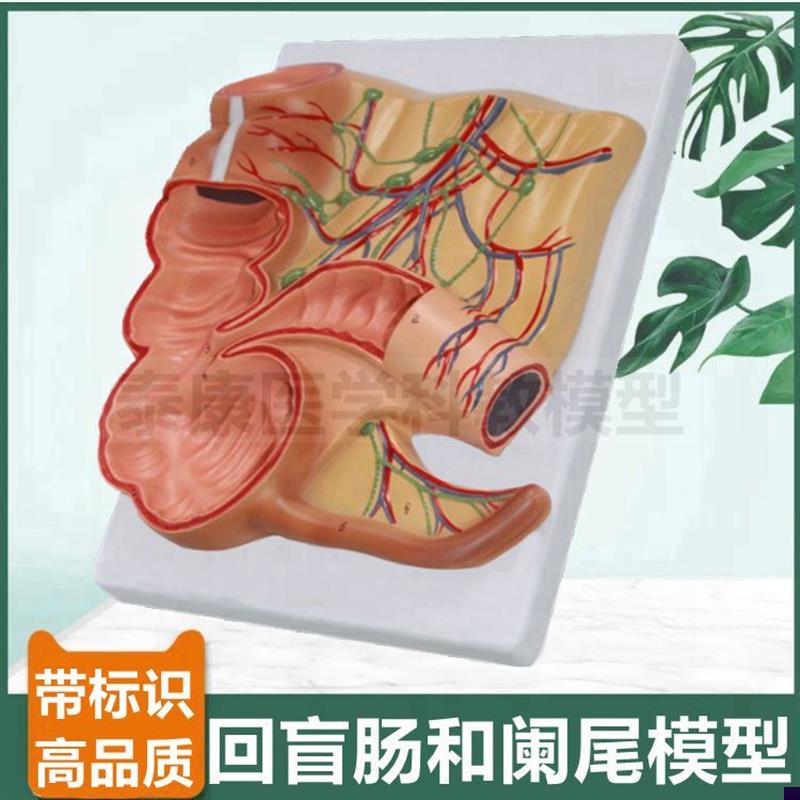 大肠模型c肠系膜血管回肠盲肠阑尾结肠病理肛周直肠痔疮肛肠医生