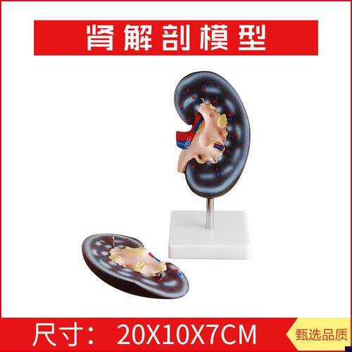 肾解剖模型2件 右肾作额状切面 示肾门 肾血管P 输尿管 肾盂 肾脏