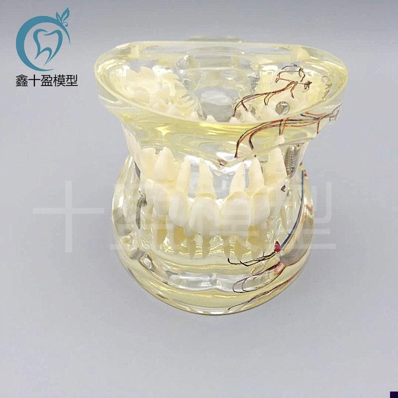 牙科水晶牙齿病理模型M4019-2成人透明病理牙模型 带Y牙神经和嵌