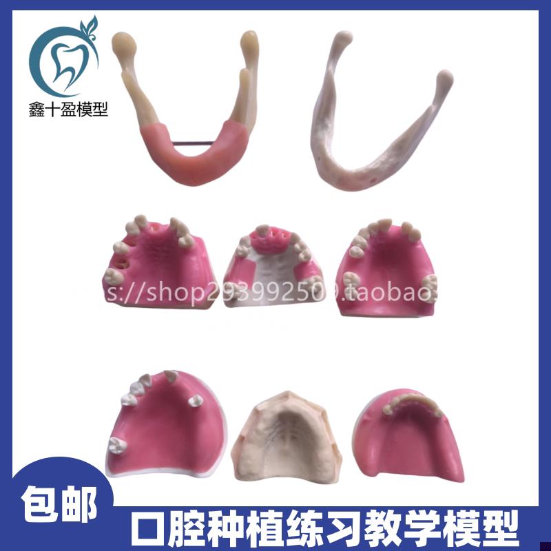 牙科 种植模型 缺失牙修复练习切开翻瓣打孔栽钉Q 仿真软牙龈 包