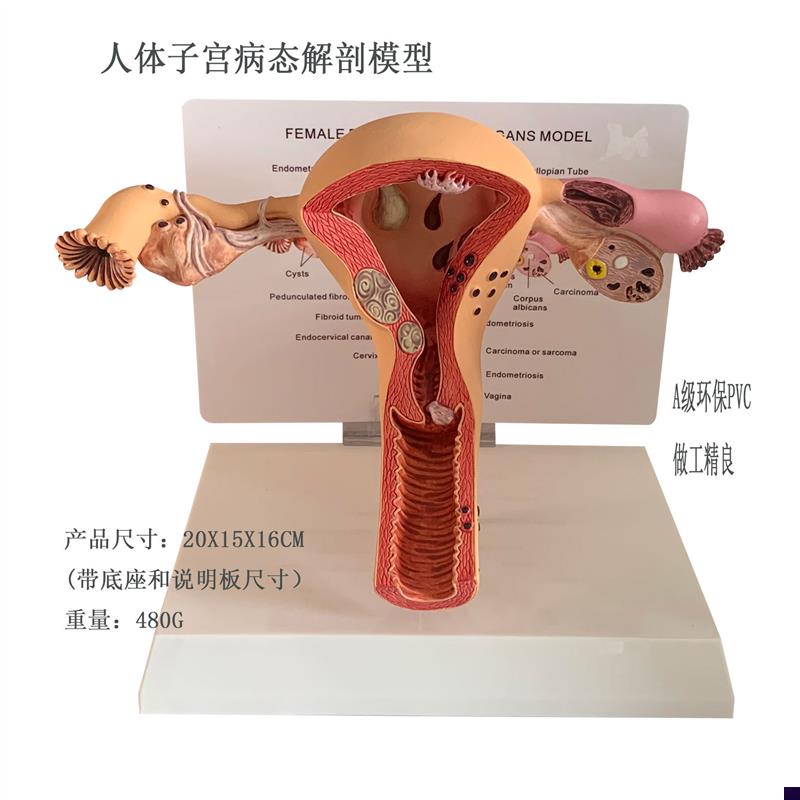 子宫解剖模型输卵管人体阴道卵巢教仪宫颈/O 癌医学厂家直销包邮