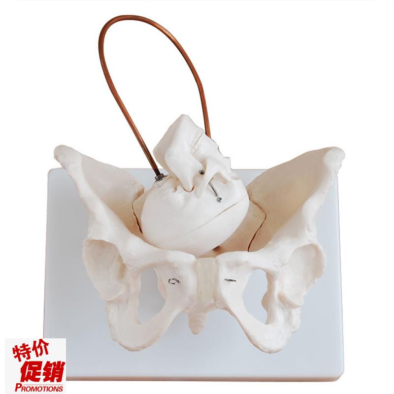 女性盆骨带胎儿W头颅骨模型