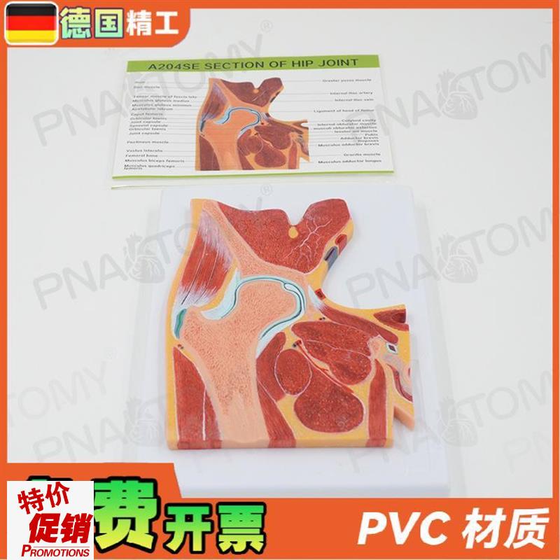 德国人体MRgI髋关节骨骼肌肉剖面构造解剖模型医学骨科疼痛科教学