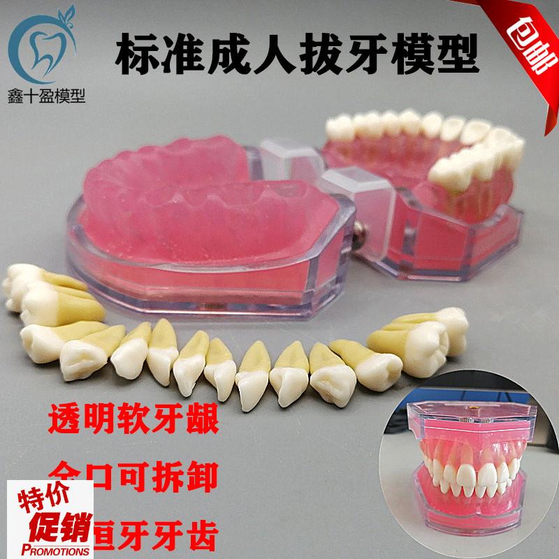 牙科教学模型口腔科练习拔牙y模型拆卸牙齿软牙龈全口可拔包邮