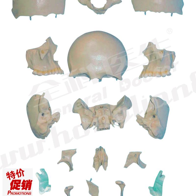 部分颅骨散骨模型A1B1117/2/骨骼模型