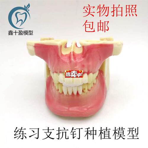 热销牙科口腔模型练习G种植模型支抗钉练习模型发泡彷真骨模型N20