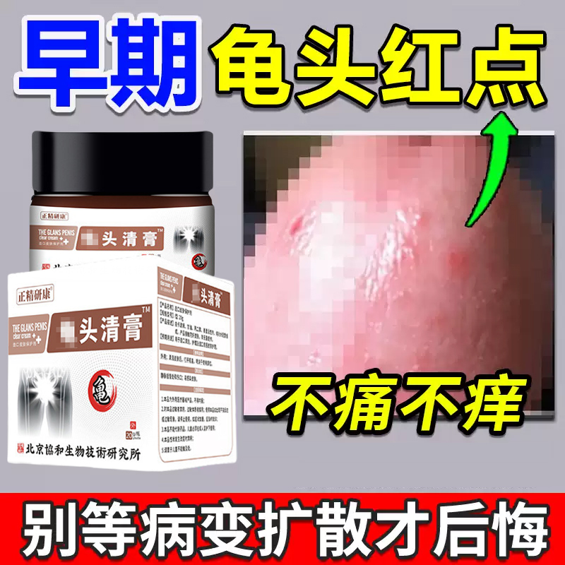 北京协和男性龟头红点真菌感染红斑红肿珍珠