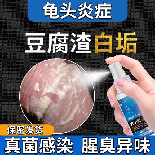 男性龟头炎包皮炎症裂口红肿瘙痒白垢喷剂