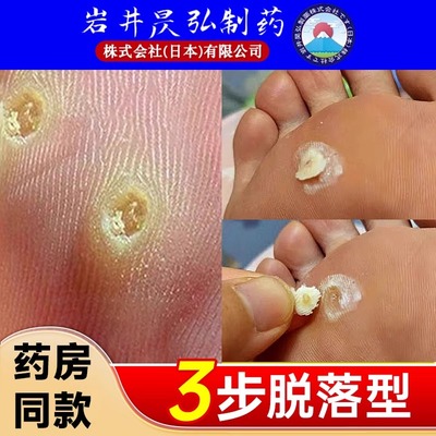日本鸡眼膏贴软化肉刺老茧