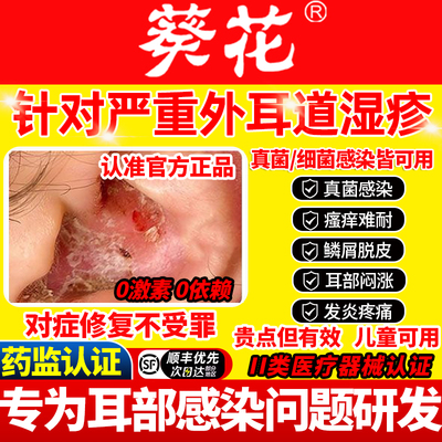 外耳道炎湿疹真菌感染耳朵痒专用