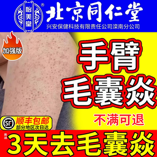 手臂毛囊炎专用脂溢性胳膊上长硬疙瘩药膏真菌感染鸡皮肤角化喷雾