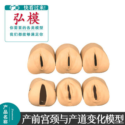 宫颈变化产道关系模型弘模宫颈管