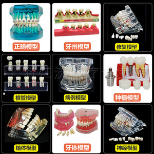 牙科牙齿模型口腔教学儿童牙模型齿科教具正畸种植牙医患沟通模型