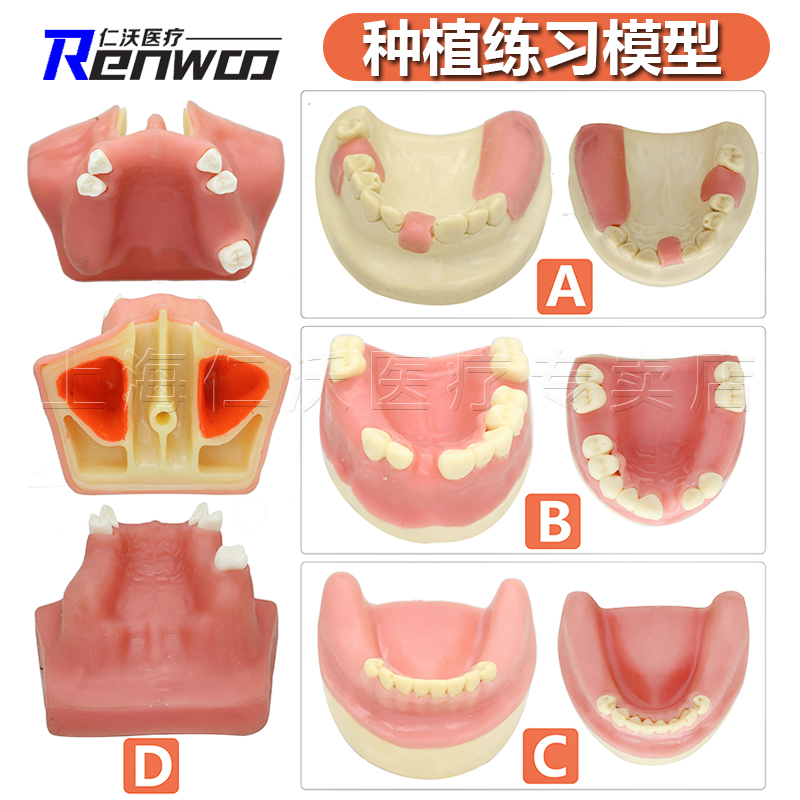 口腔种植练习模型 半口 全口 种植模型 模具 种植体 牙科种植模型 美容美体仪器 其它口腔护理设备 原图主图