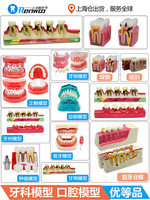 牙齿模型 口腔模型 牙科标准牙模 牙模型 教学假牙带神经医患沟通