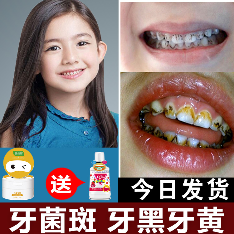 儿童去牙菌斑黑牙祛除神器儿童牙粉漱杀菌防蛀清新【2月9日发完】