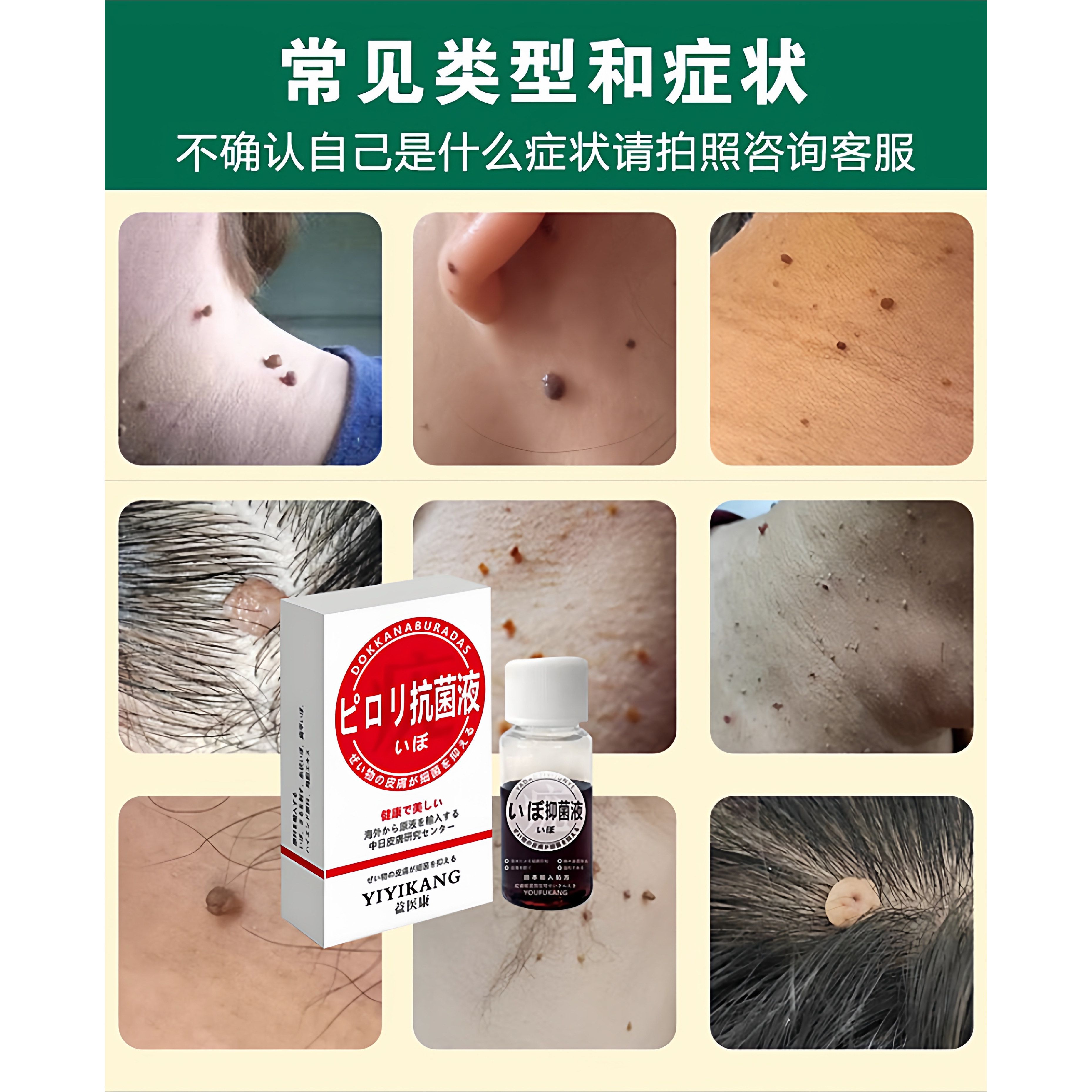 克尤液尤体克星灵病毒湿忧瘊平除寻常偏平丝状优快不留疤包邮