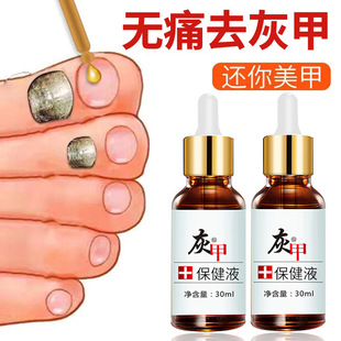 去灰指甲特效液发黑分离去除增厚灰甲亮甲脱甲膏喷剂专用抑菌液