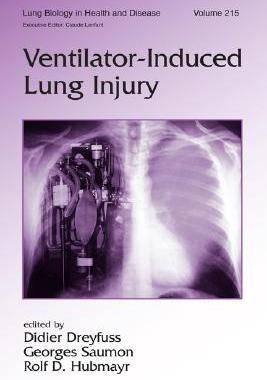 【预订】Ventilator-Induced Lung Injury