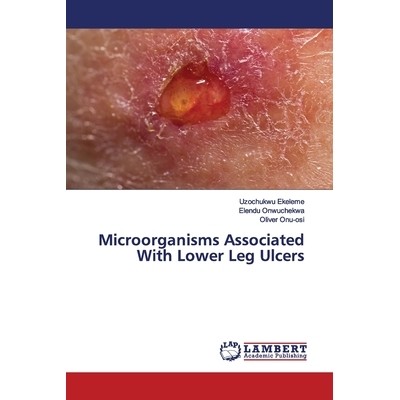 预订 Microorganisms Associated With Lower Leg Ulcers: 9786200092380