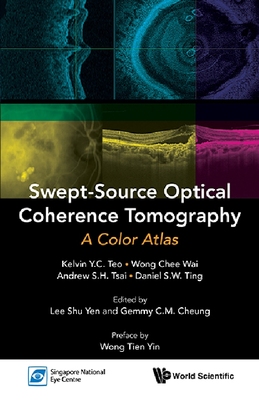 【预订】SWEPT-SOURCE OPTICAL COHERENCE TOMOGRAPHY