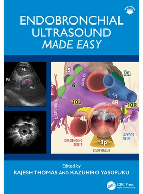 预订 Endobronchial Ultrasound Made Easy: 9780367630751