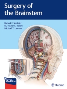 【预订】Surgery of the Brainstem