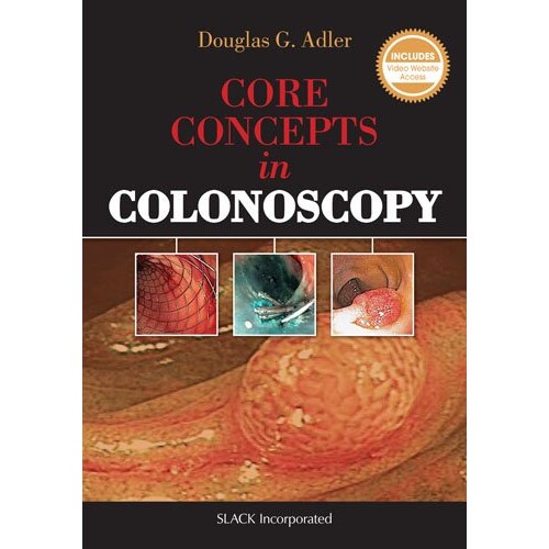 预订 Core Concepts in Colonoscopy 结肠镜检查的核心概念 9781617116148