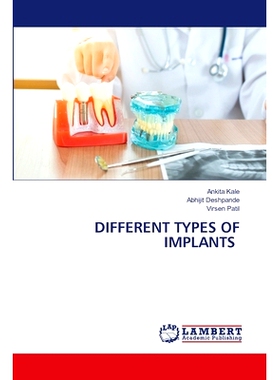 预订 Different Types of Implants 不同类型的植入物: 9786208116491