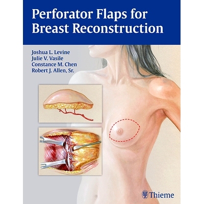 预订 Perforator Flaps for Breast Reconstruction 穿支皮瓣乳房重建: 9781626230941