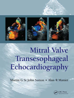 【预订】Mitral Valve Transesophageal Echocardiography