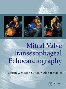 【预订】Mitral Valve Transesophageal Echocardiography