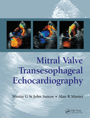 【预订】Mitral Valve Transesophageal Echocardiography