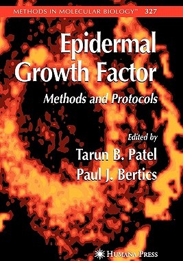 【预订】Epidermal Growth Factor