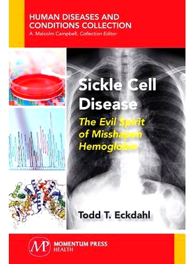 预订 Sickle Cell Disease: The Evil Spirit of Misshapen Hemoglobin: The Evil Spirit of Misshapen Hemoglobin: 978194474975