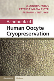 【预订】Handbook of Human Oocyte Cryopreservation