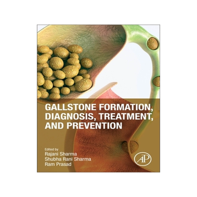 预订 Gallstone Formation, Diagnosis, Treatment and Prevention