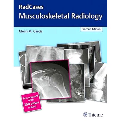 预订 RadCases Q&A Musculoskeletal Radiology RadCases Q&A 肌肉骨骼放射学: 9781626232440