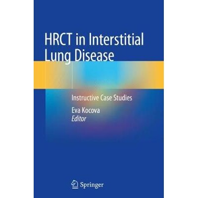 预订 HRCT in Interstitial Lung Disease Instructive Case Studies 间质性肺疾病的高分辨率计算机体层x线摄影术:指导性案例研