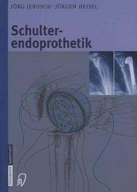 预订 Schulterendoprothetik: Indikation, Implantate, Op-Technik, Nachbehandlung, Begutachtung