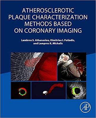 【预订】Atherosclerotic Plaque Characterization Methods Based on Coronary Imaging