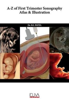 [预订]A-Z of First Trimester Sonography Atlas & Illustration 9781636481968